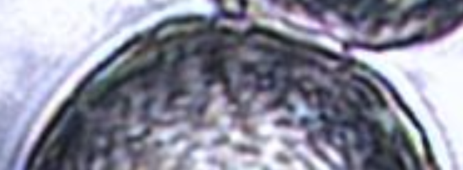 图6 — 裁剪不当图像的示例。数据集中此类图像会对分类模型的性能产生负面影响。